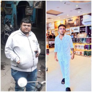 Patient before and after weight loss surgery